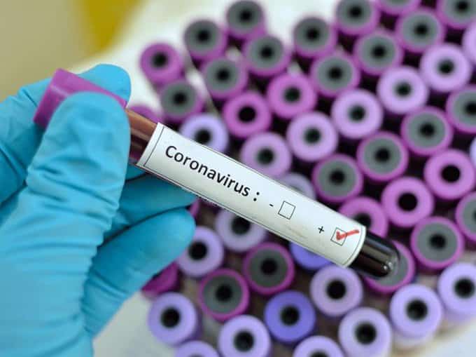 Coronavirus: South Africa Now has 3158 COVID-19 Cases covid-19